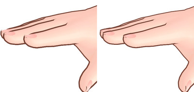 yubi1.jpg